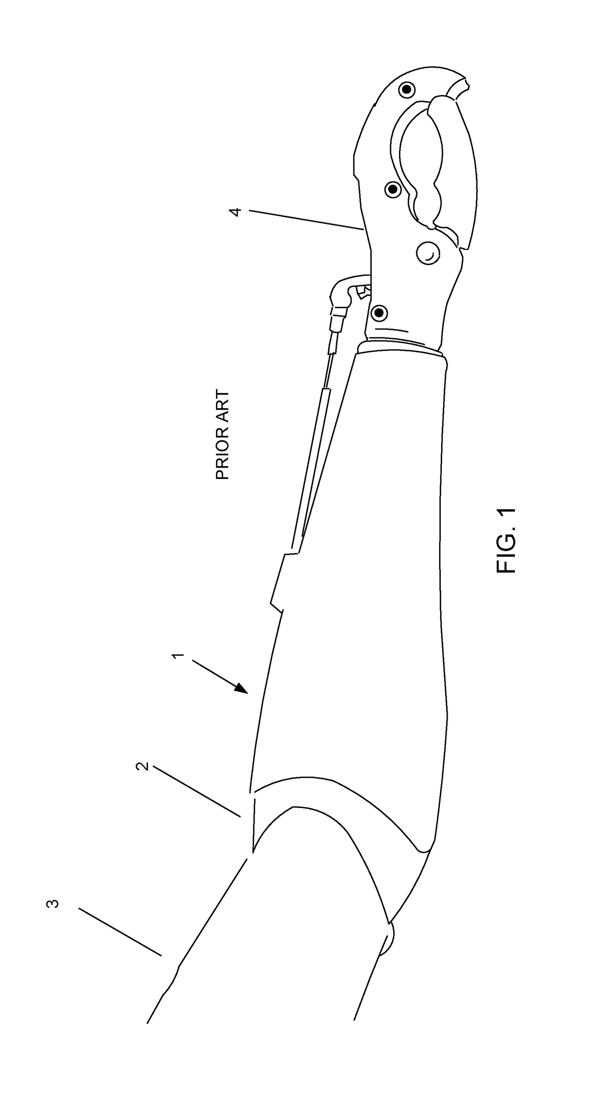 Prosthetic attachment