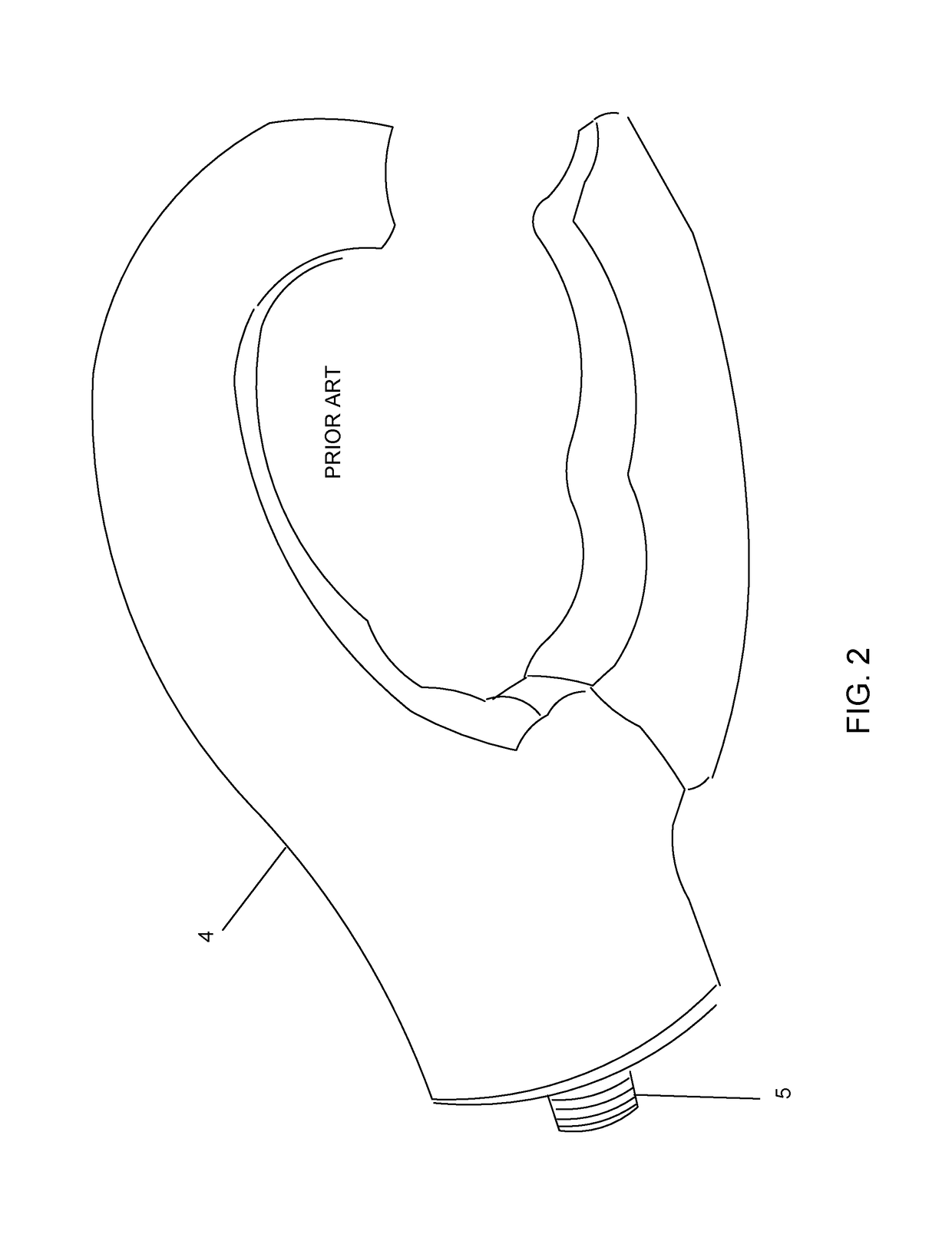 Prosthetic attachment