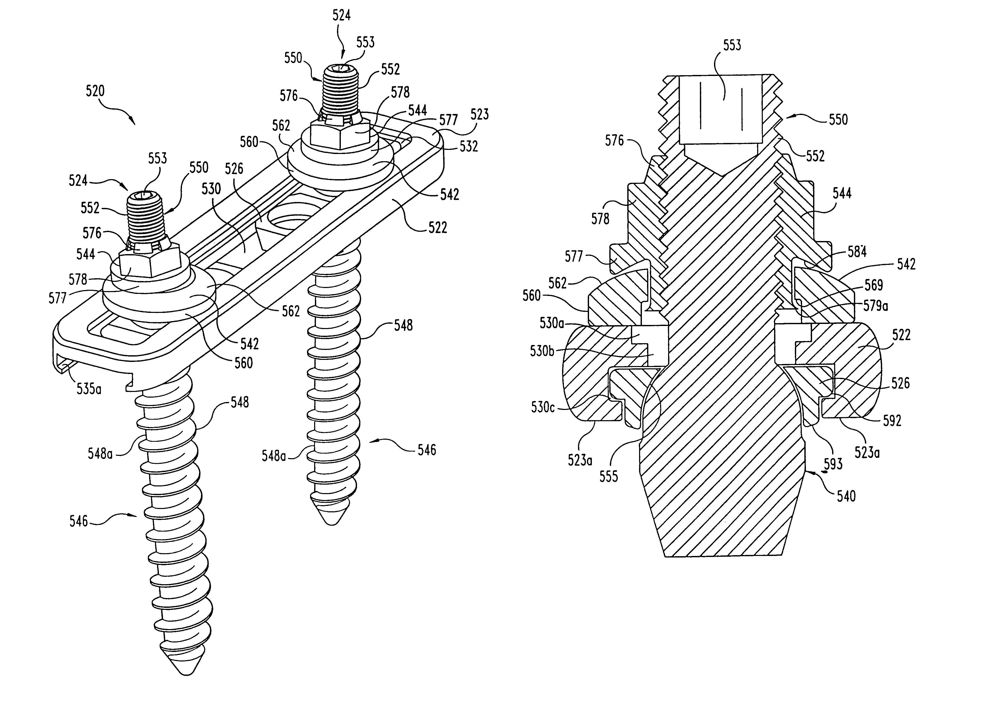 Multi-axial bone anchor system