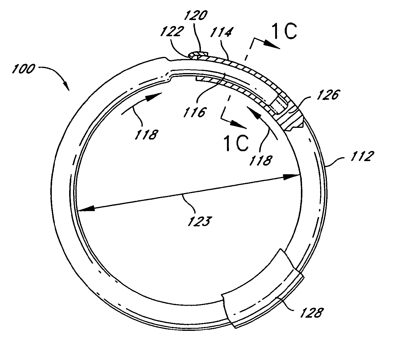 Adjustable annuloplasty ring activation system