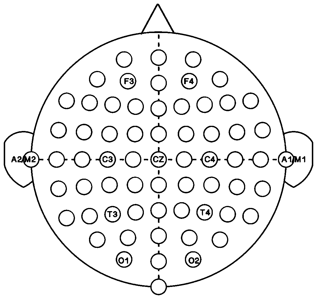 Electroencephalogram sleep staging method based on deep convolutional neural network