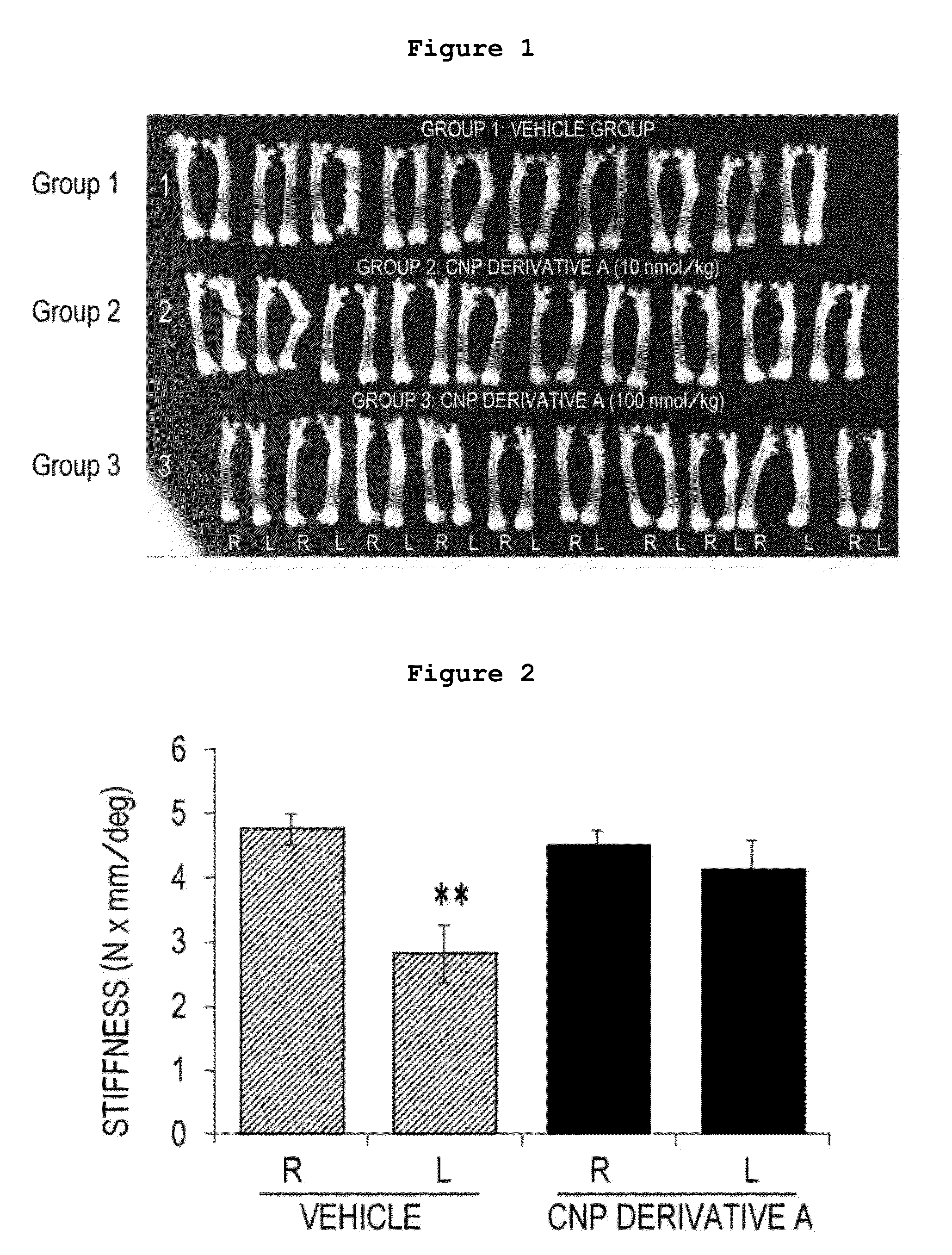 Bone repair promoter