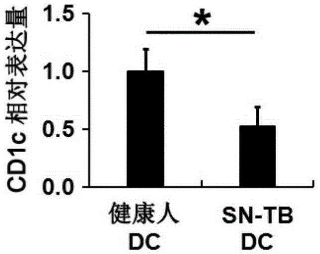 Application of CD1c to smear and culture negative pulmonary tuberculosis diagnosis