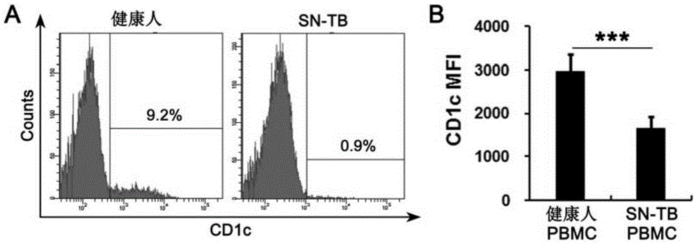 Application of CD1c to smear and culture negative pulmonary tuberculosis diagnosis