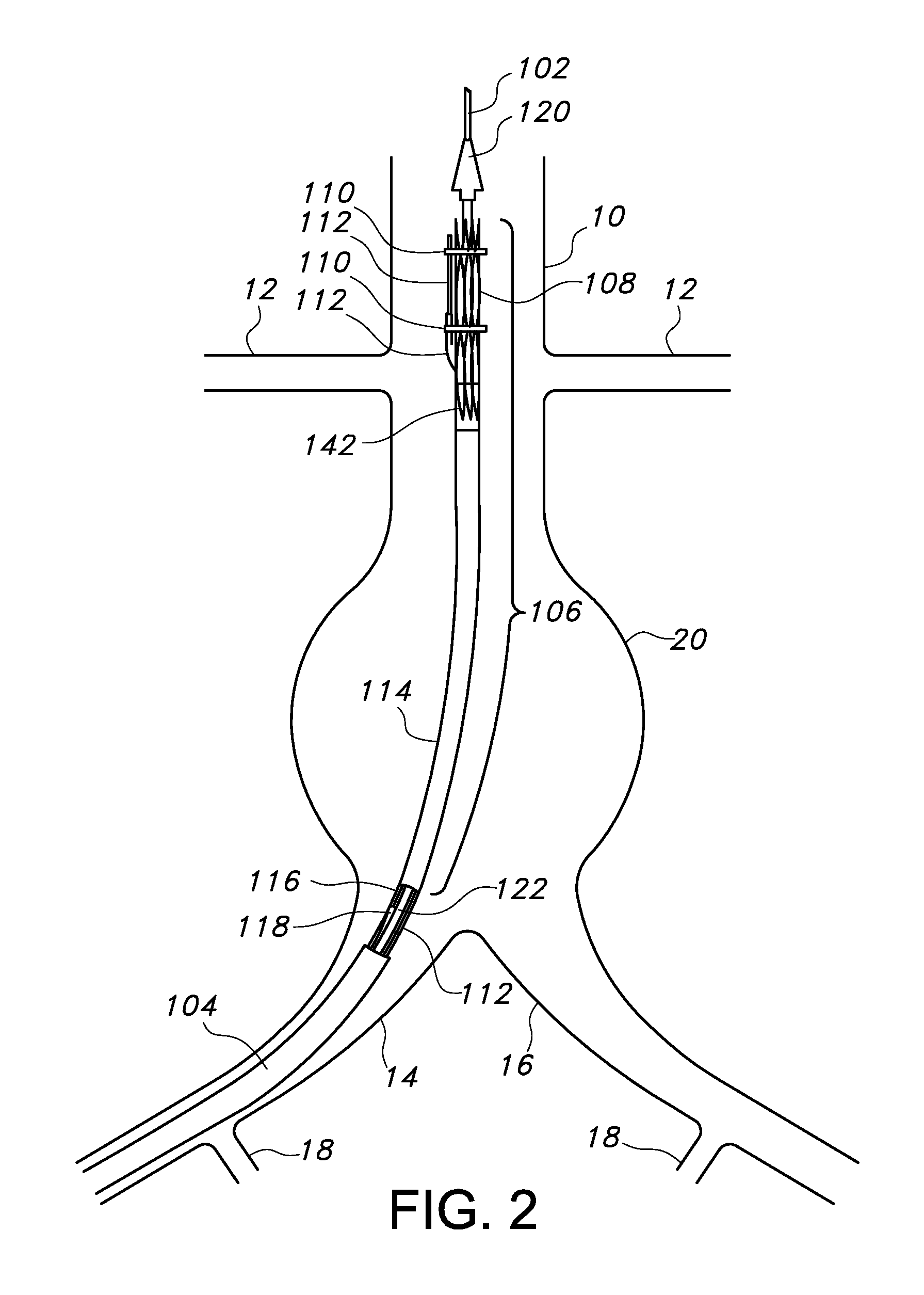 Endovascular delivery system with an improved radiopaque marker scheme