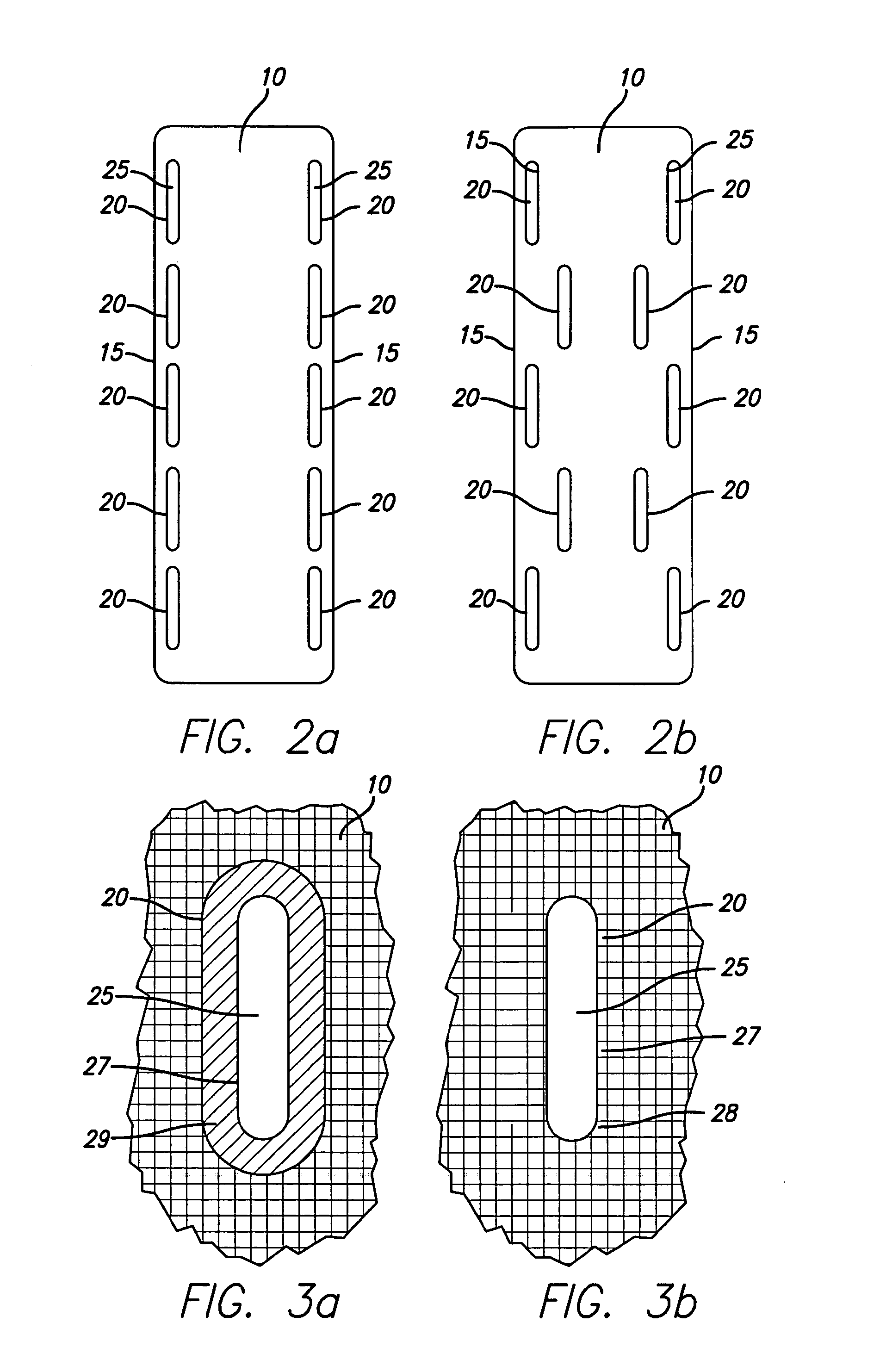 Bone anchored surgical mesh