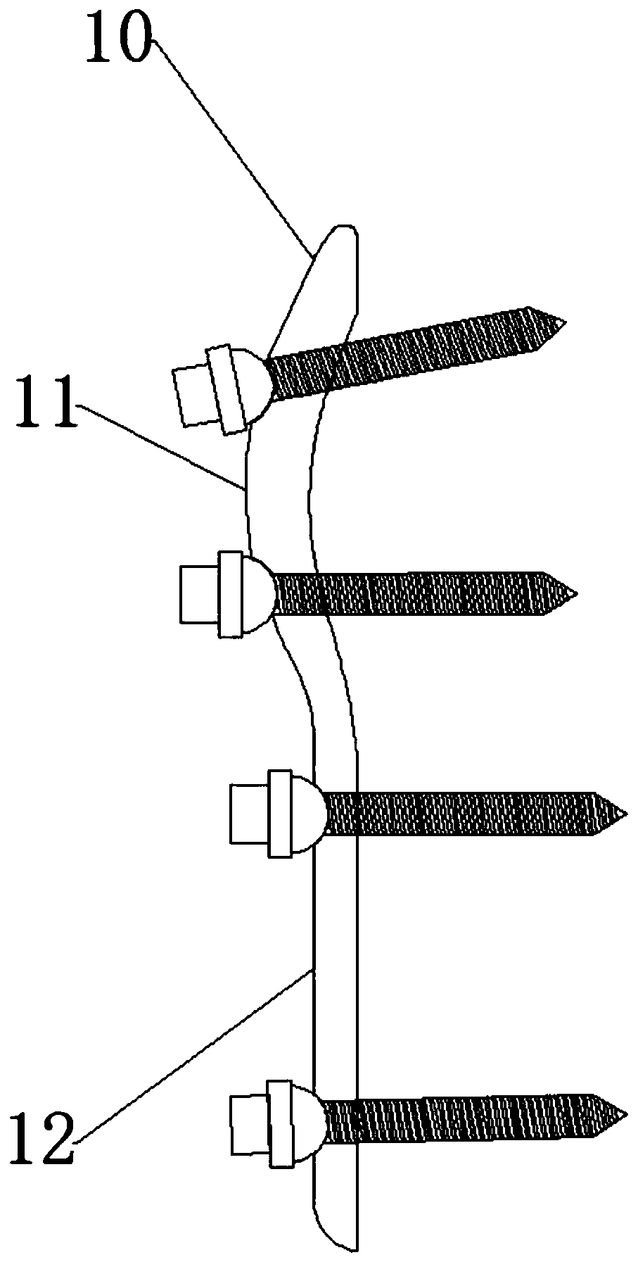 Proximal humerus rear side anatomical type auxiliary steel plate