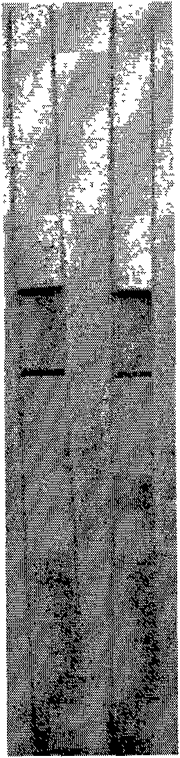 Colloidal gold quick detection test paper of retinal binding protein