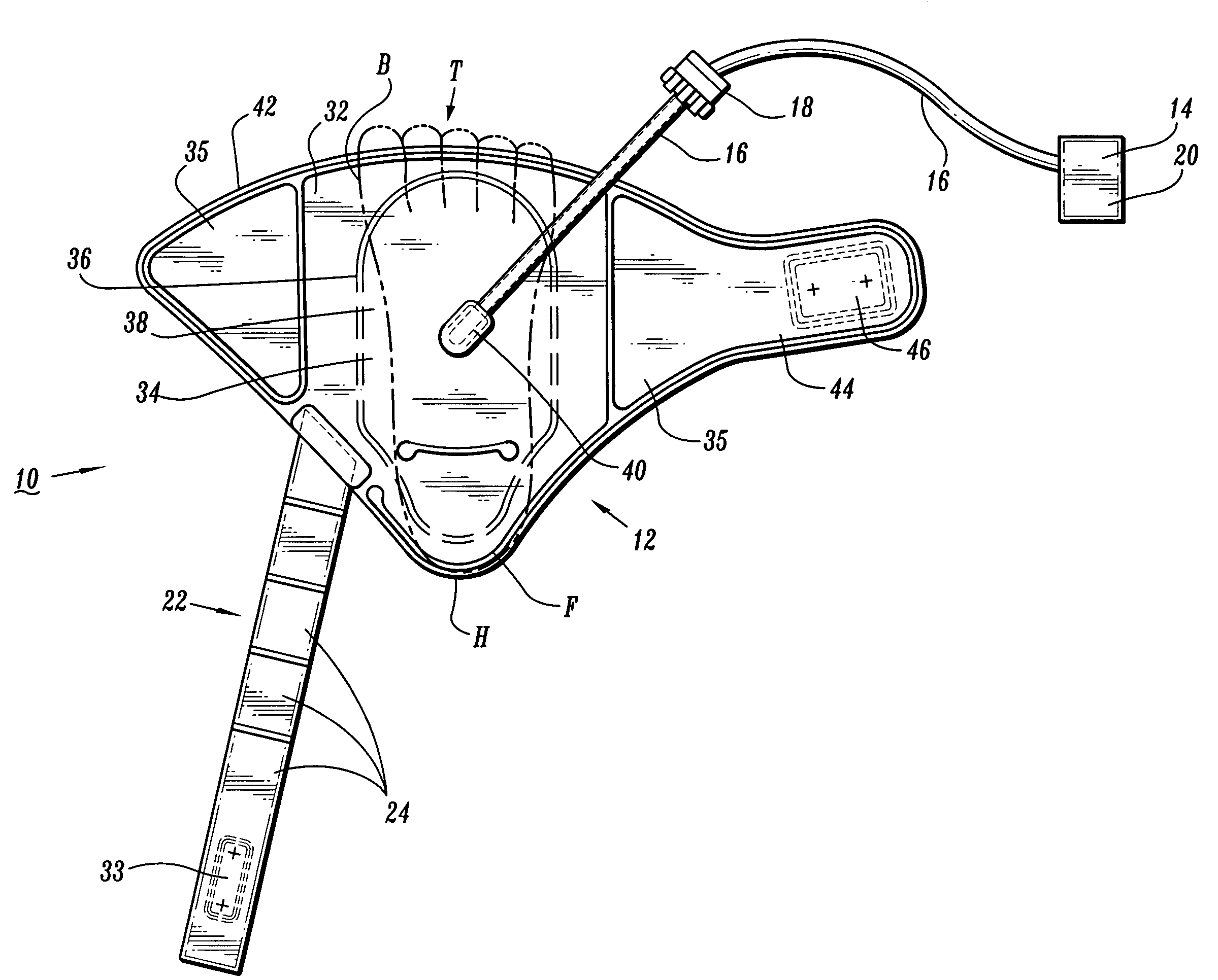 Compression apparatus