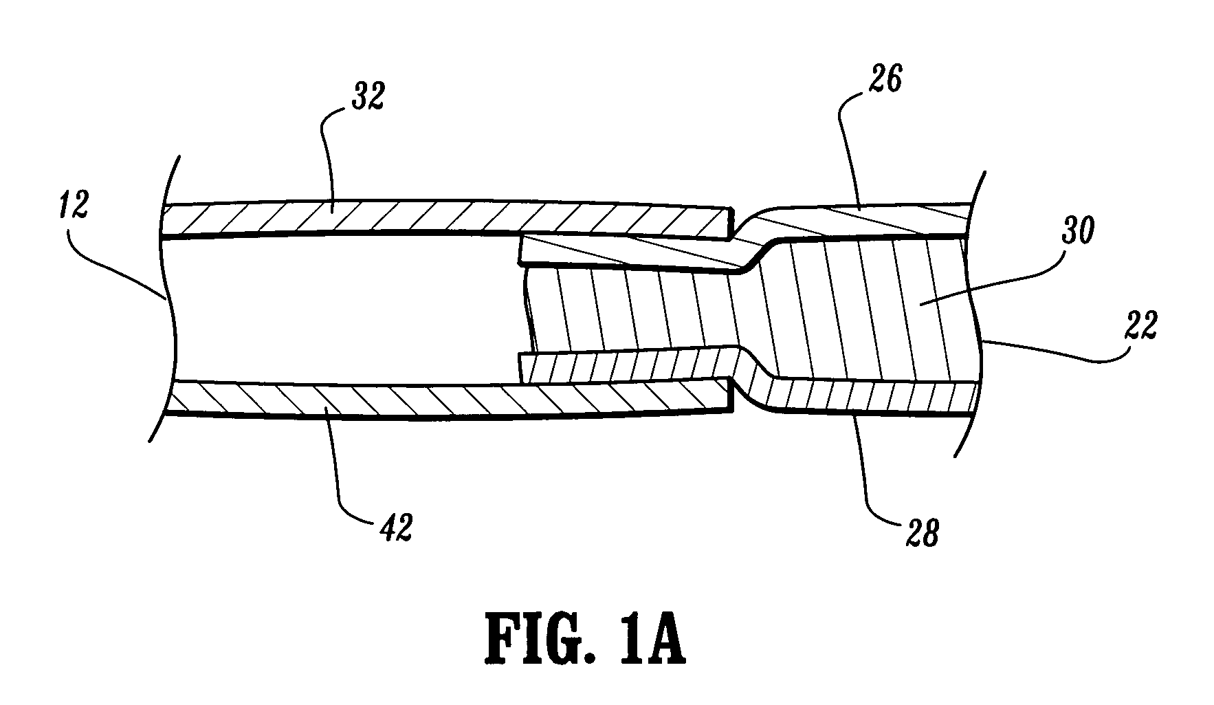 Compression apparatus