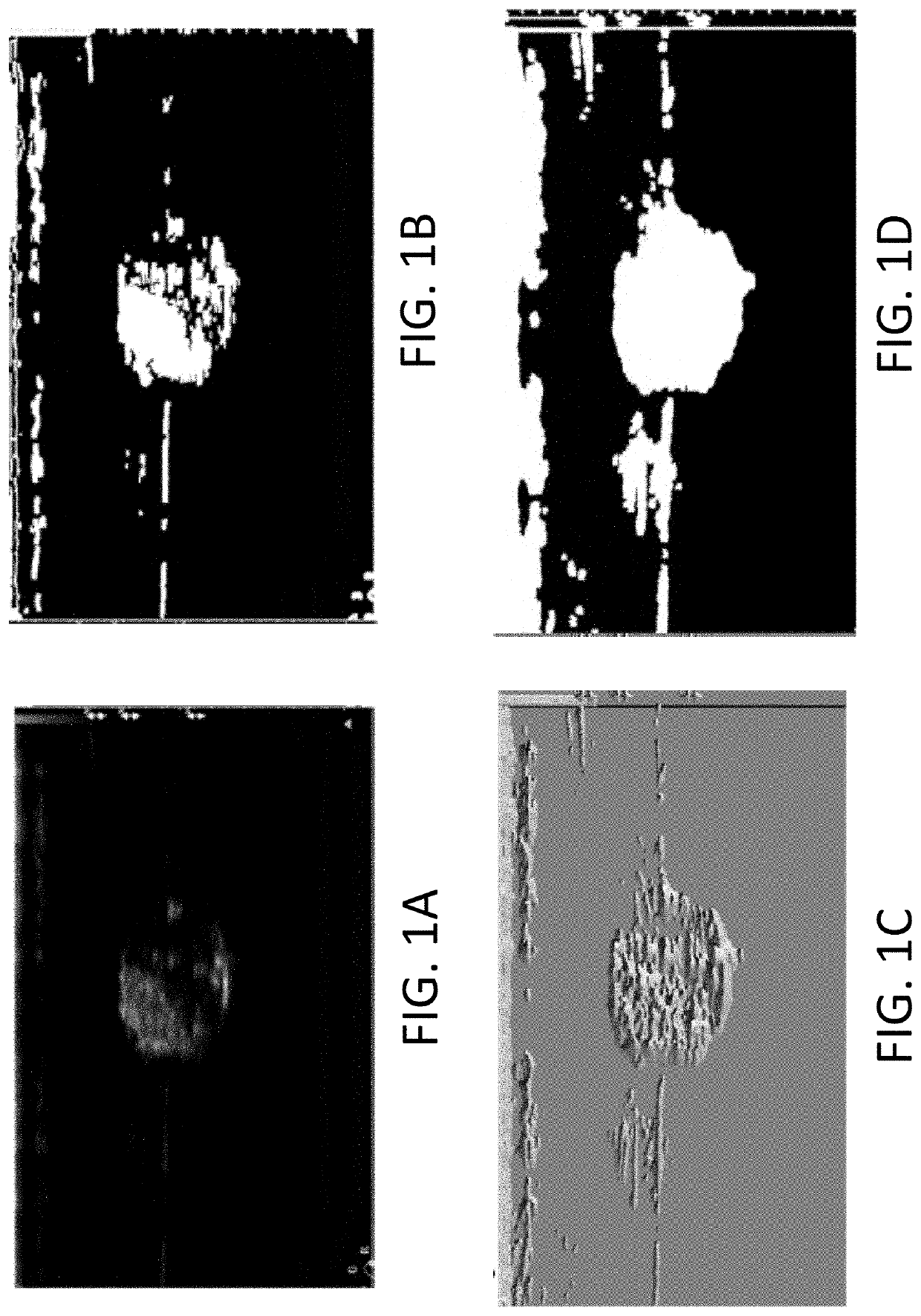 Systems and methods for automated image recognition of implants and compositions with long-lasting echogenicity