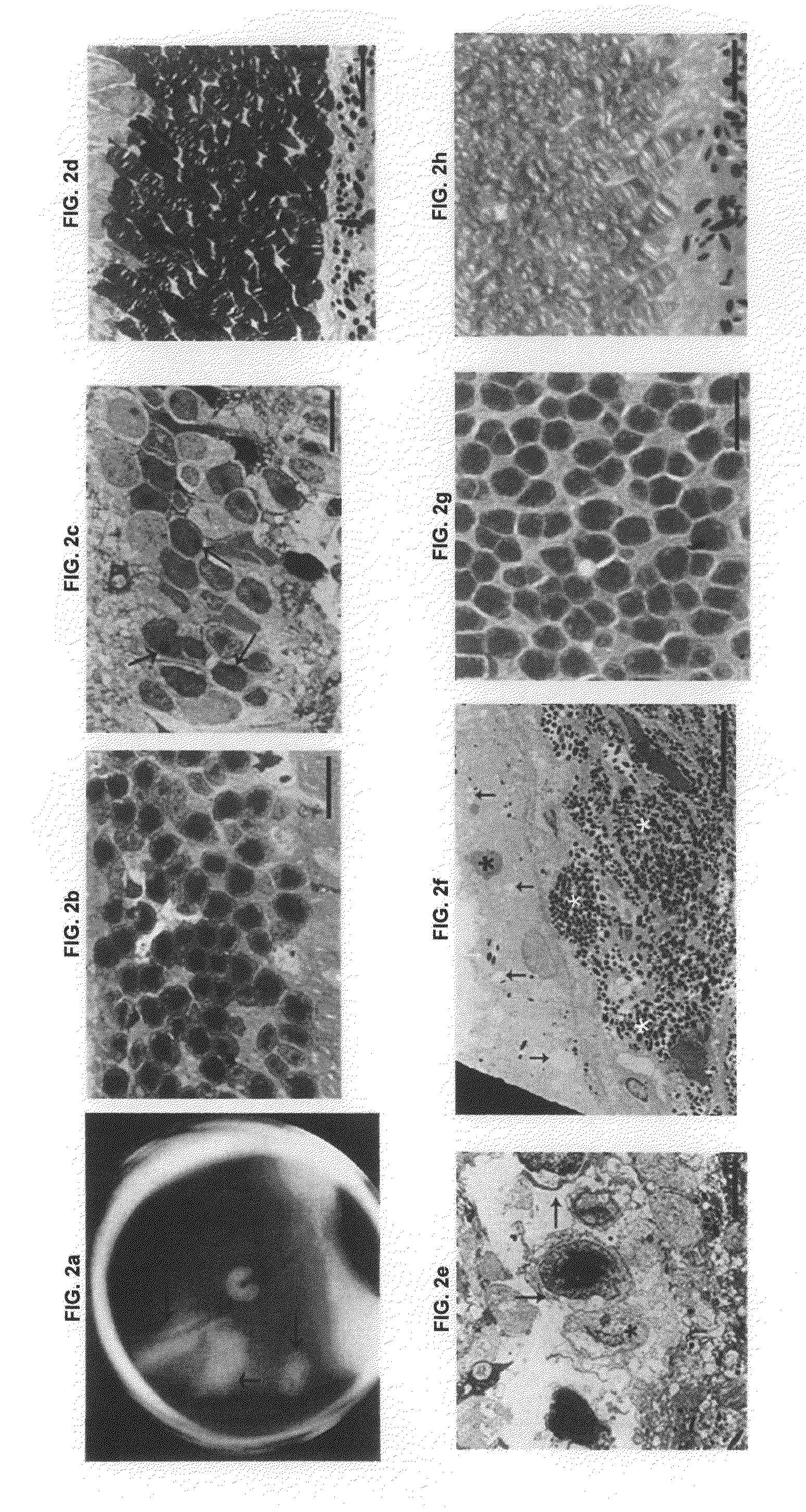 Methods and animal model for analyzing age-related macular degeneration