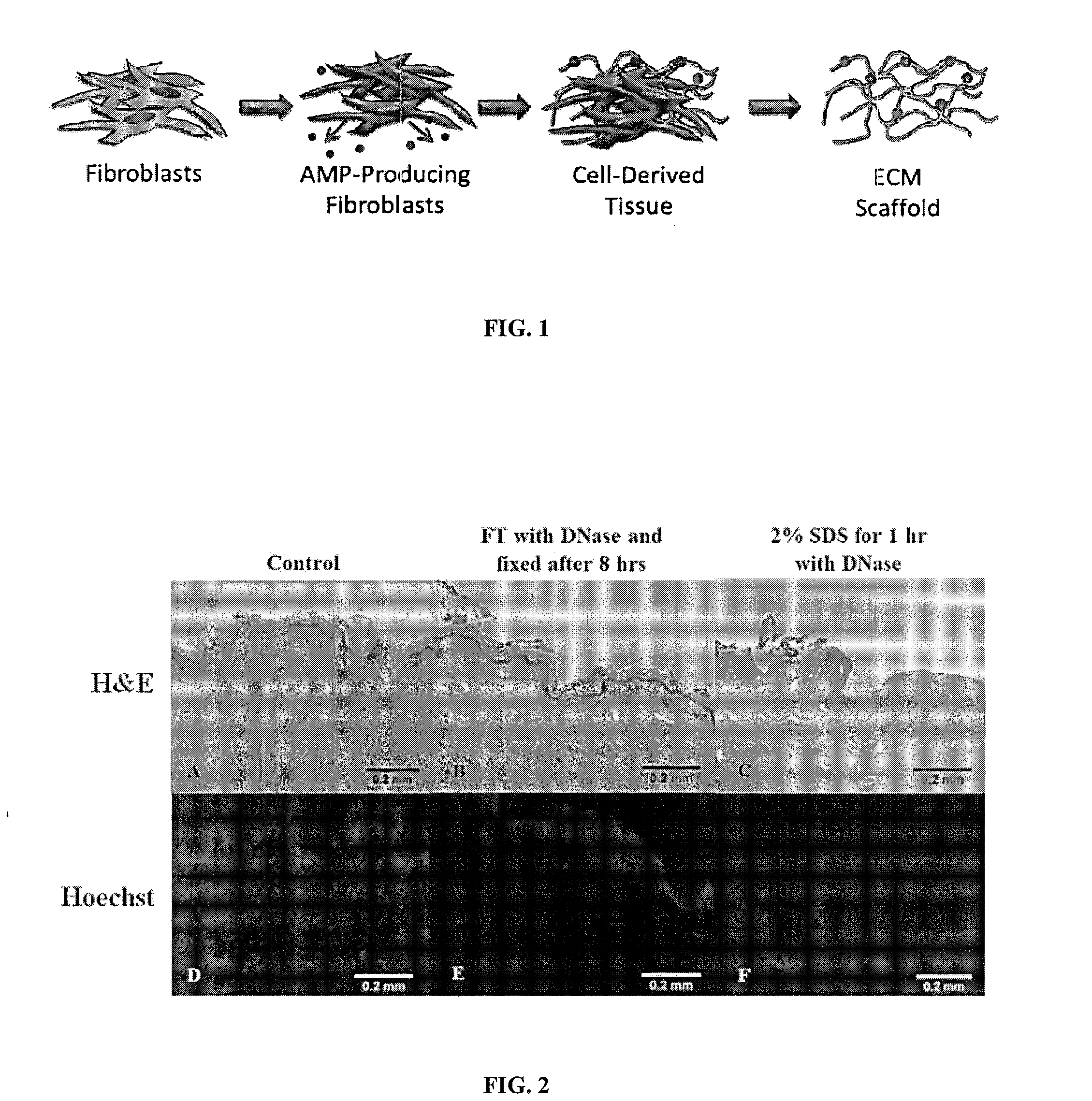 Matrix scaffold with antimicrobial activity