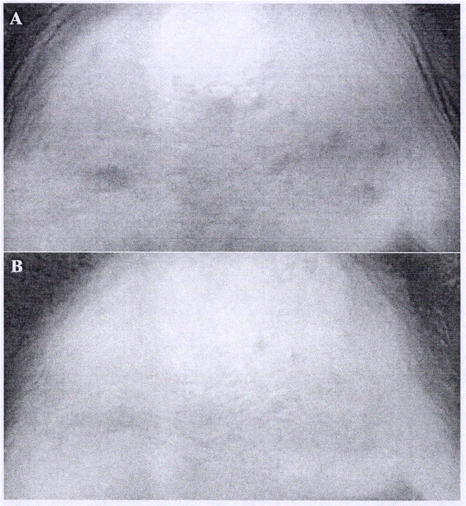 Preparing method of immune-cell-derived biological-beautifying raw materials and products thereof