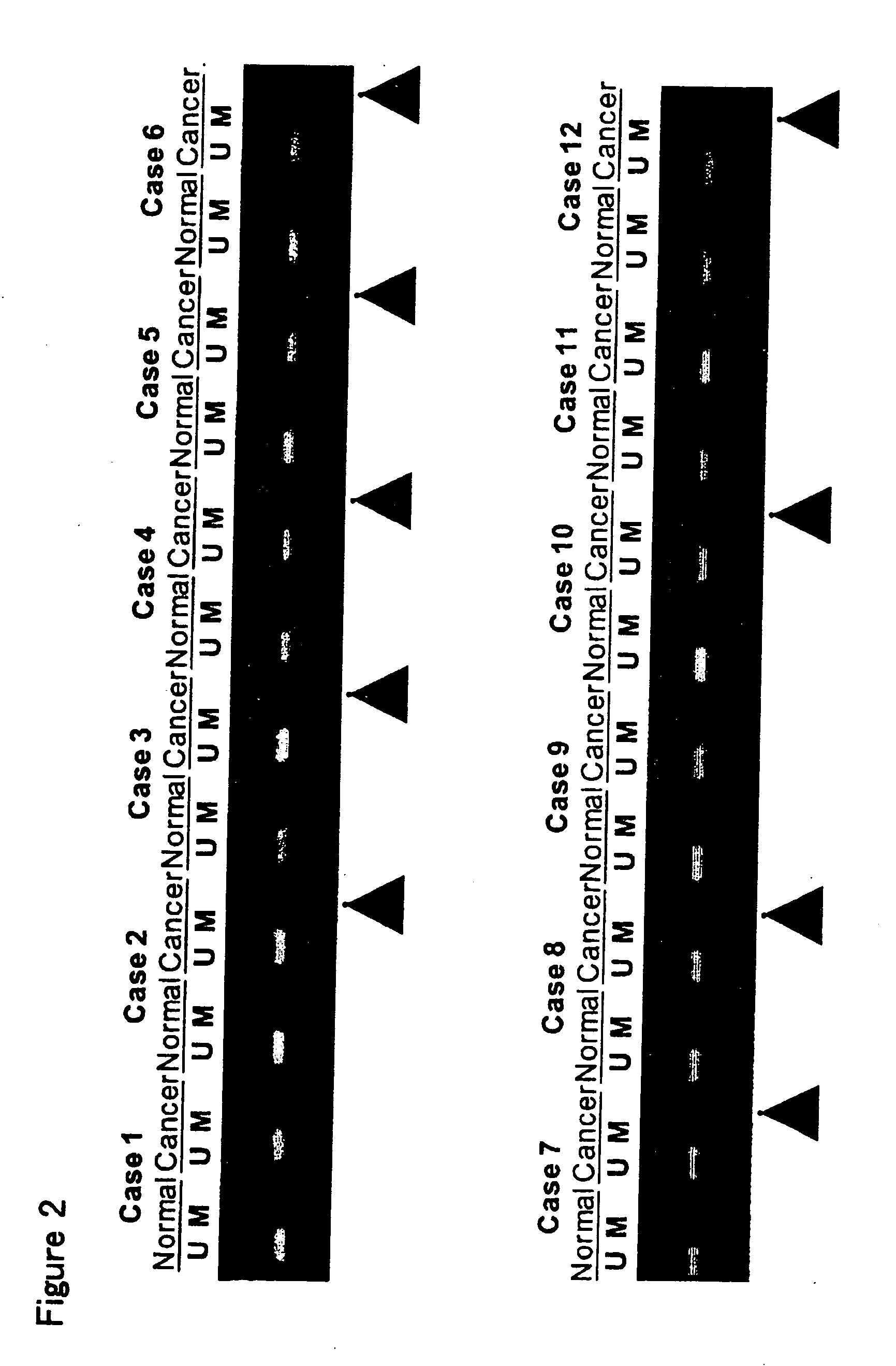 Method for Assessing Cancerous State