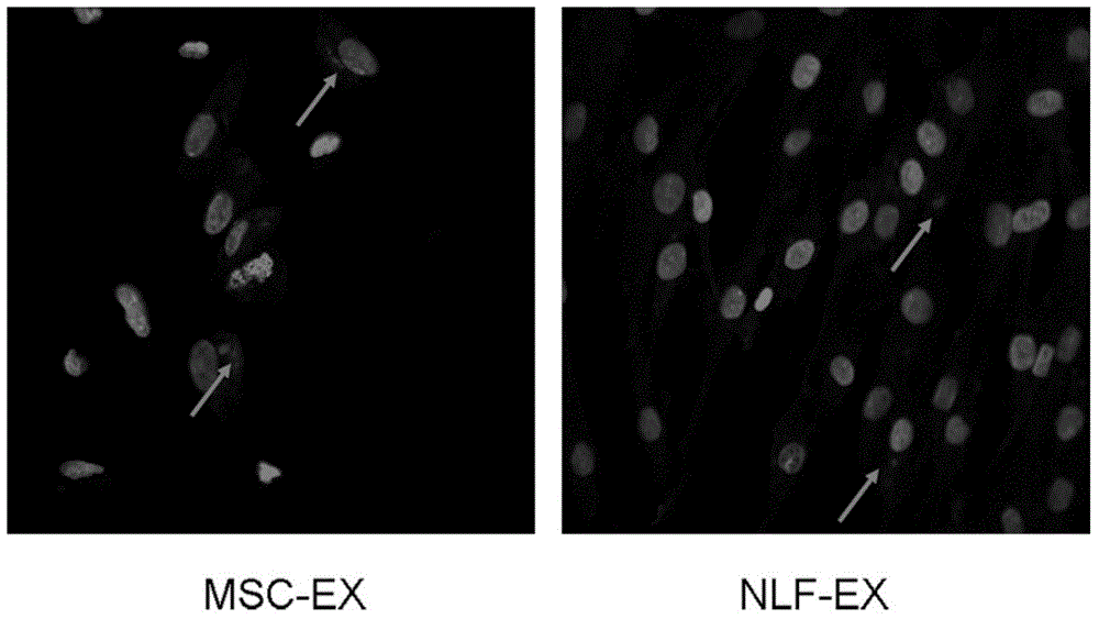 Application of MSC (mesenchymal stem cell) exosomes in preparation of pharmaceutic preparation for treating PF (pulmonary fibrosis)