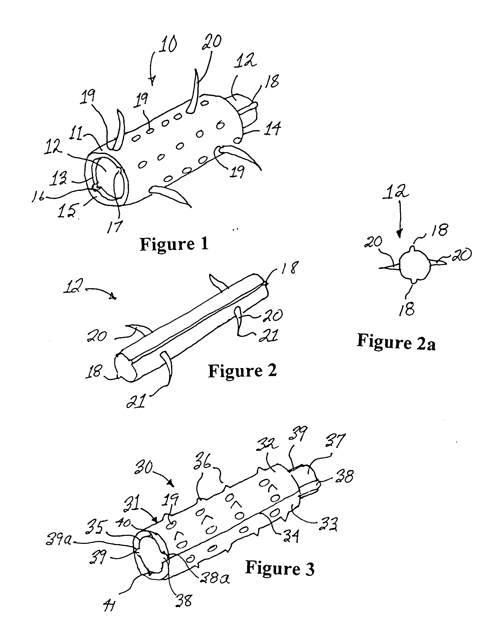 Intervertebral prosthesis