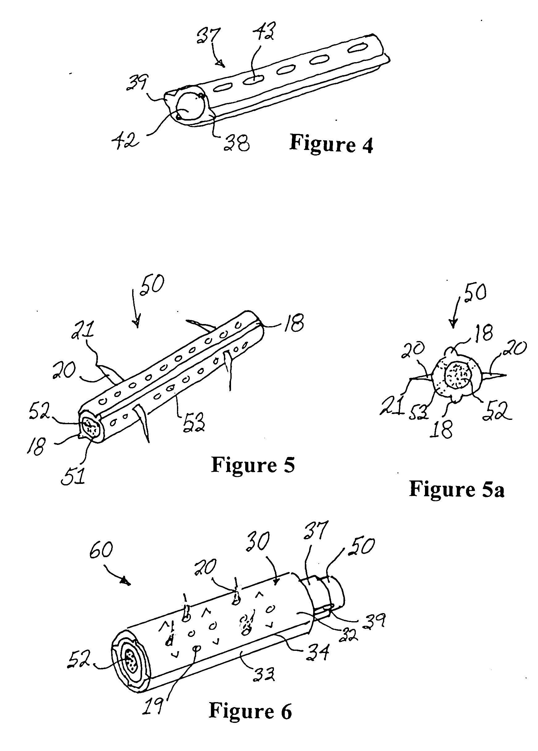 Intervertebral prosthesis