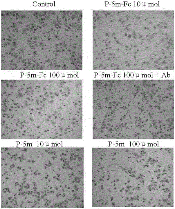 P-5m-Fc fusion protein and expression gene thereof, and preparation method and applications of P-5m-Fc fusion protein