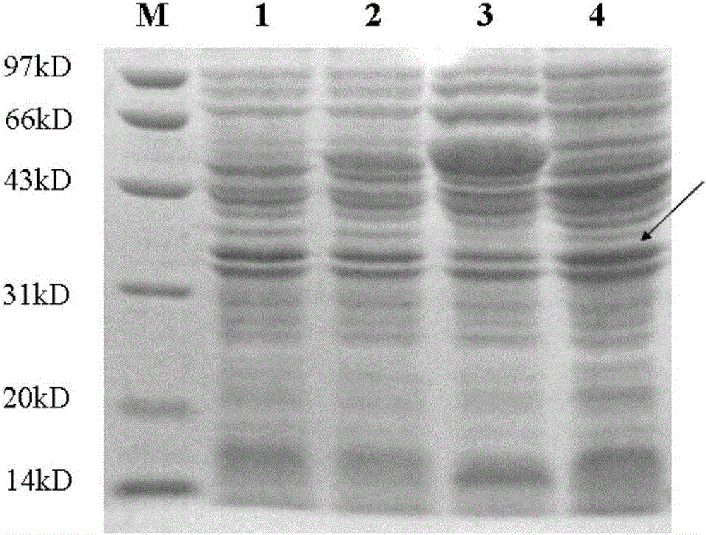 P-5m-Fc fusion protein and expression gene thereof, and preparation method and applications of P-5m-Fc fusion protein