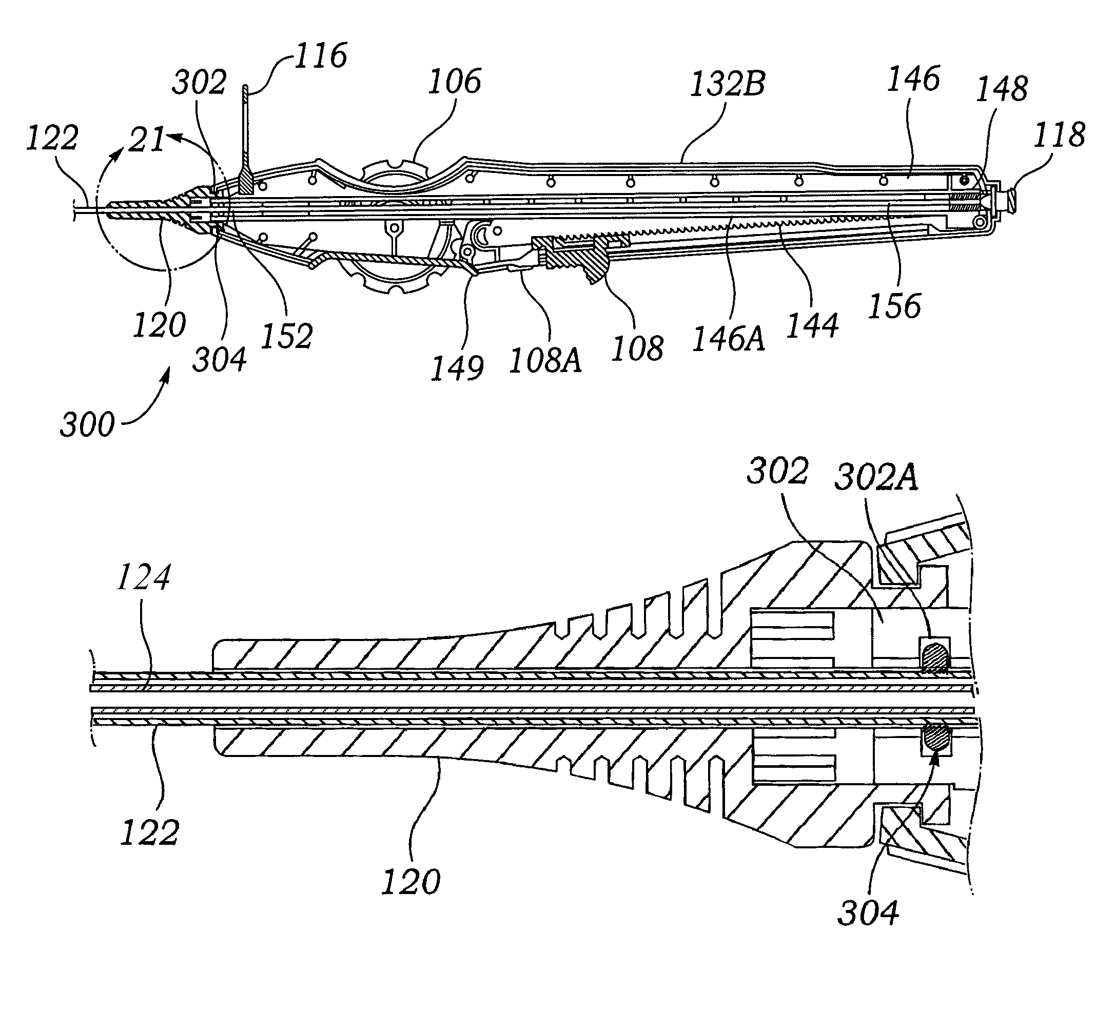 Stent delivery system