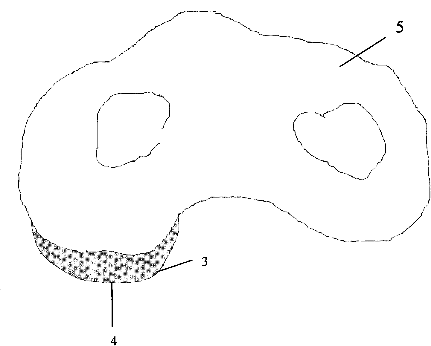 Rear anatomical supporting and locking plate in proximal tibial plateau