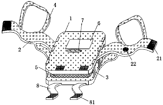 Lung protection device for cardiothoracic surgery