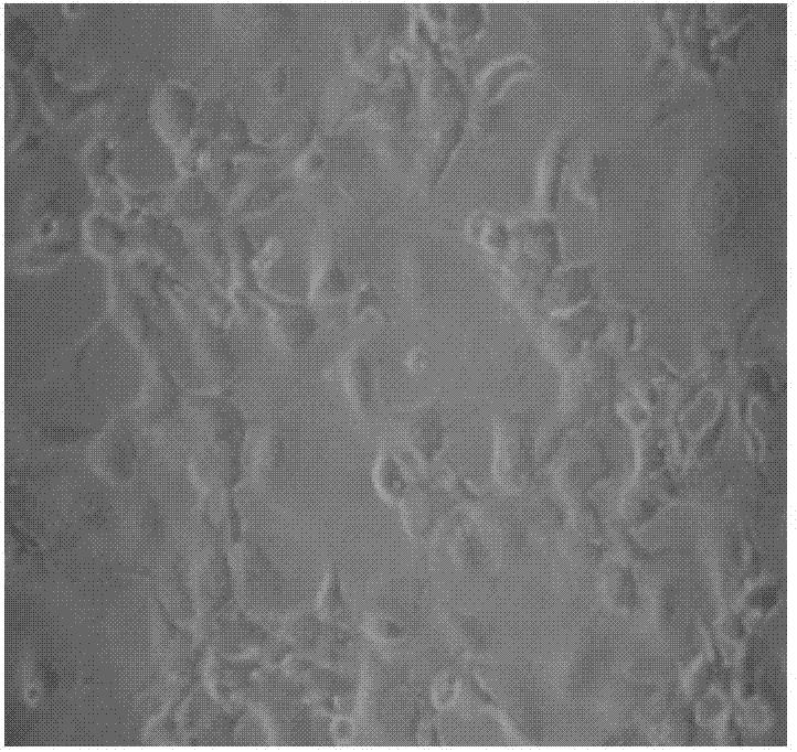 Cell culture medium and application thereof in culturing primary human tumor cells