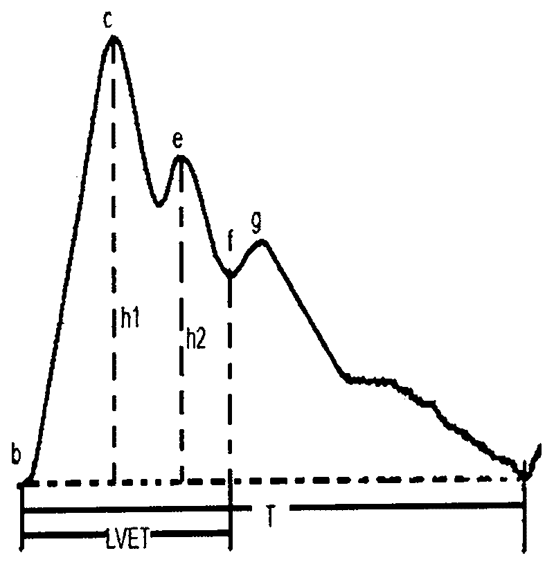 Radial artery pulse wave based cardiovascular function parameter detection and analysis method and detection device