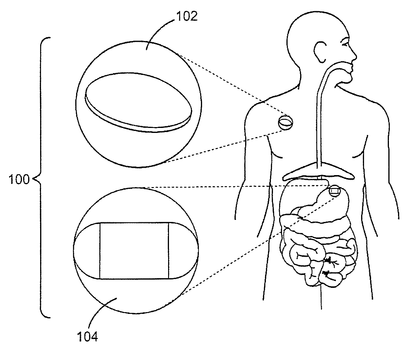 Ingestible event marker systems