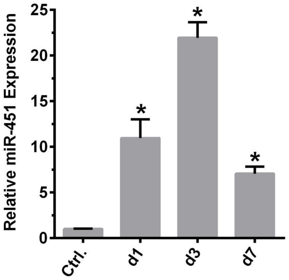 Application of micromolecule RNA hsa-miR-451a in preparation of medicine for treating cerebral arterial thrombosis