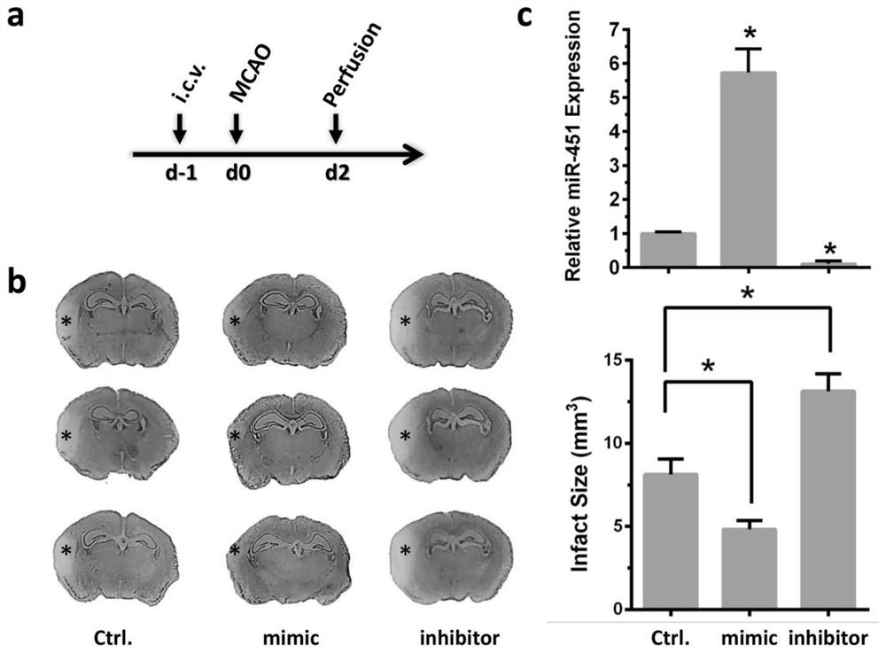 Application of micromolecule RNA hsa-miR-451a in preparation of medicine for treating cerebral arterial thrombosis