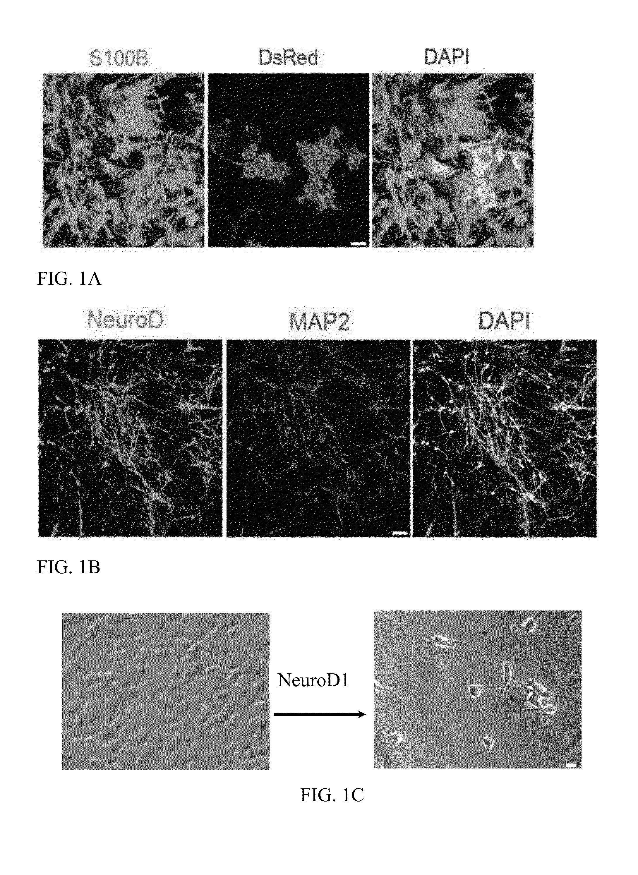 Methods and compositions for treatment of disease or injury of the nervous system