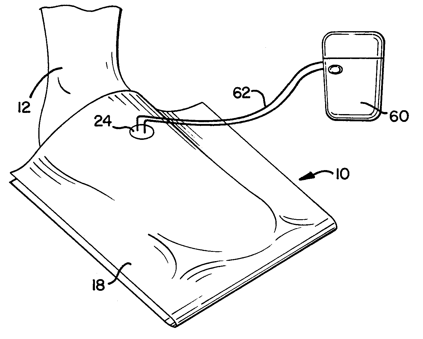 Negative Pressure Wound Therapy Device