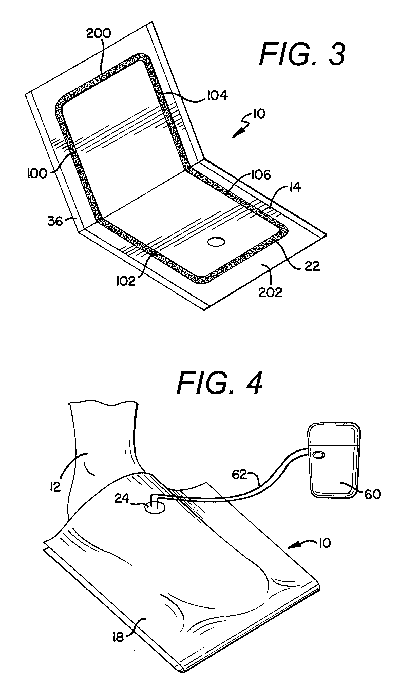 Negative Pressure Wound Therapy Device