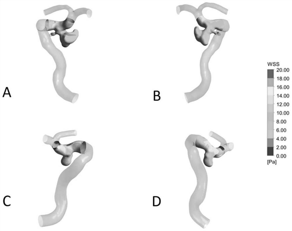 Method and device for constructing model for predicting intracranial aneurysm rupture