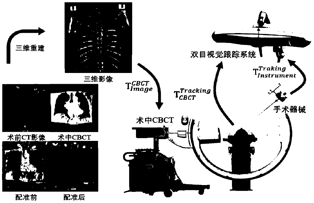 Orthopedic surgery navigation system based on multimode image fusion