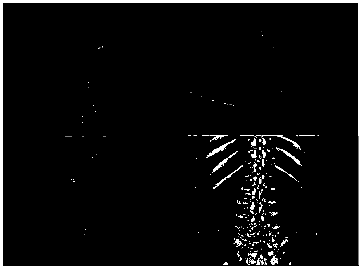 Orthopedic surgery navigation system based on multimode image fusion