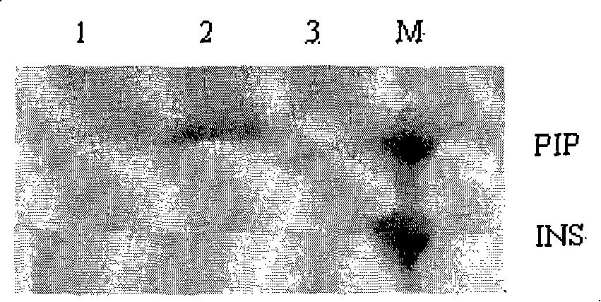 Improved gene construction method and property testing of fast-acting insulin precursor