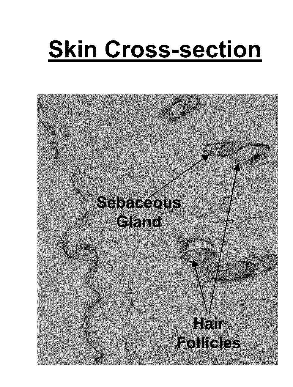 Methods and compositions for treating onchomycosis