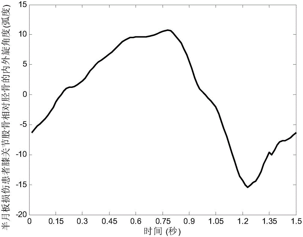 Gait analysis method for assisting in screening meniscus injuries