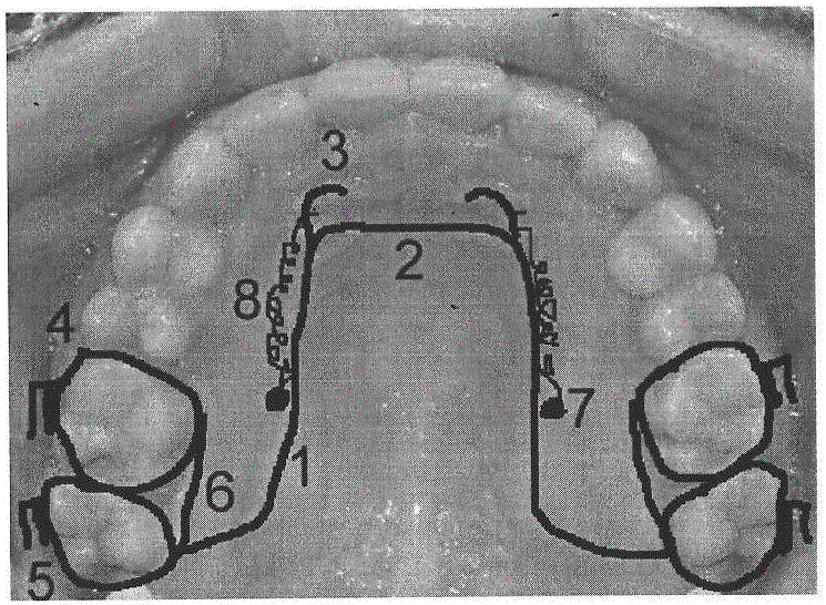 Tooth correcting appliance and use method thereof