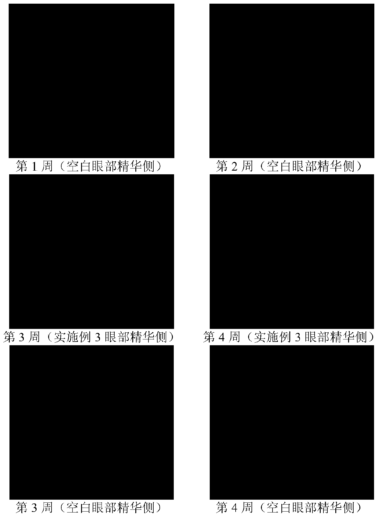 Eye essence and preparation method thereof