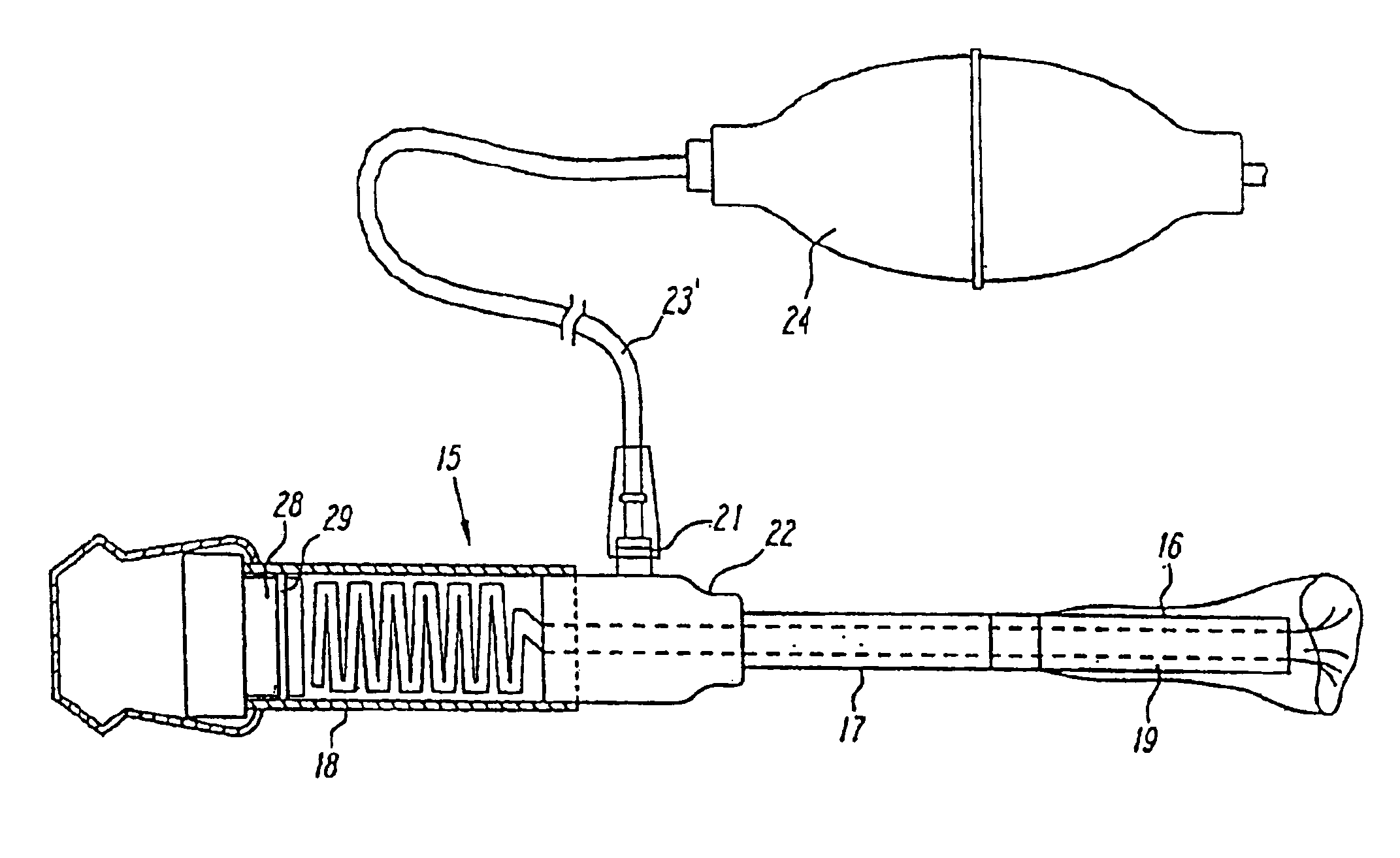 Methods and devices for blood vessel harvesting