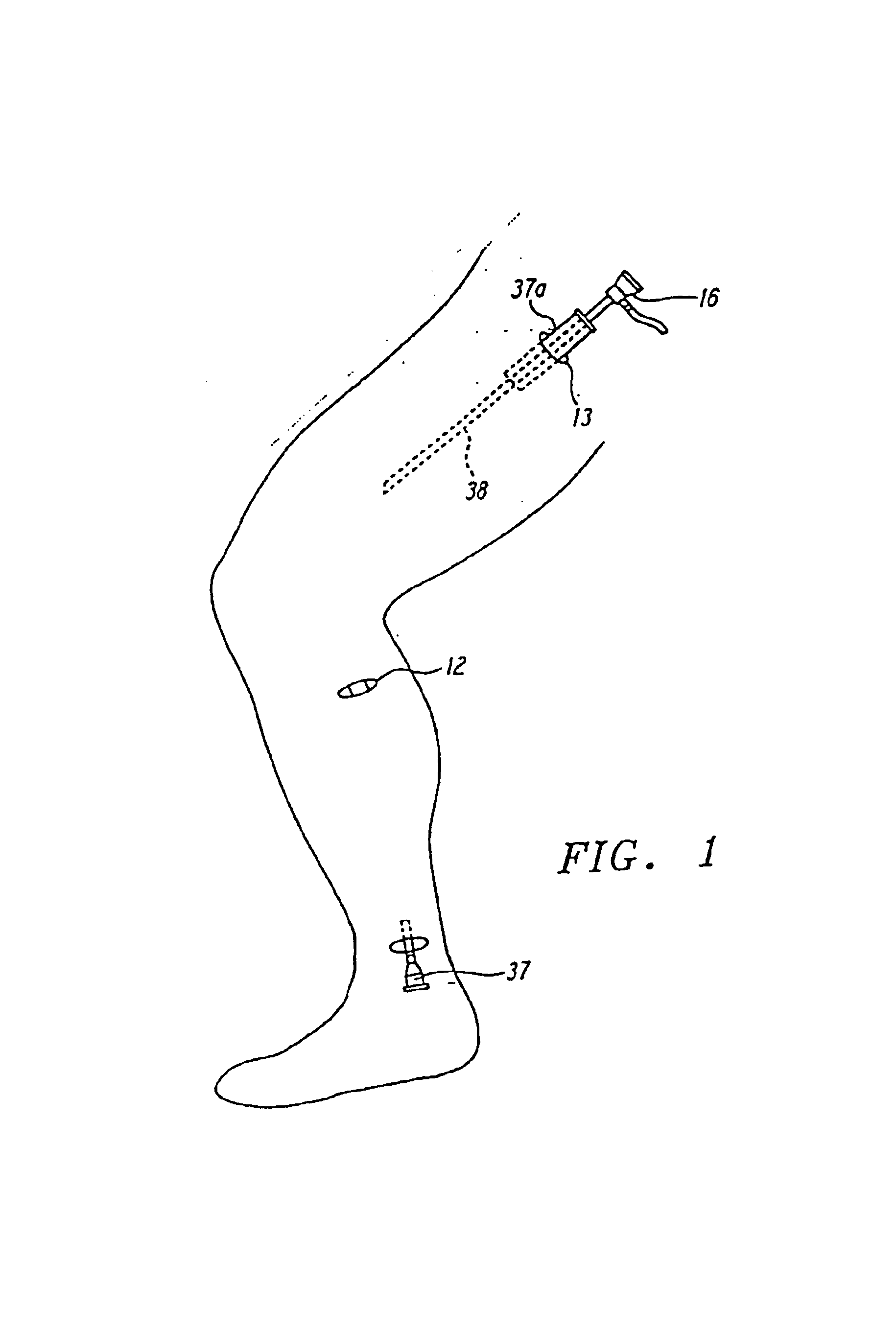 Methods and devices for blood vessel harvesting