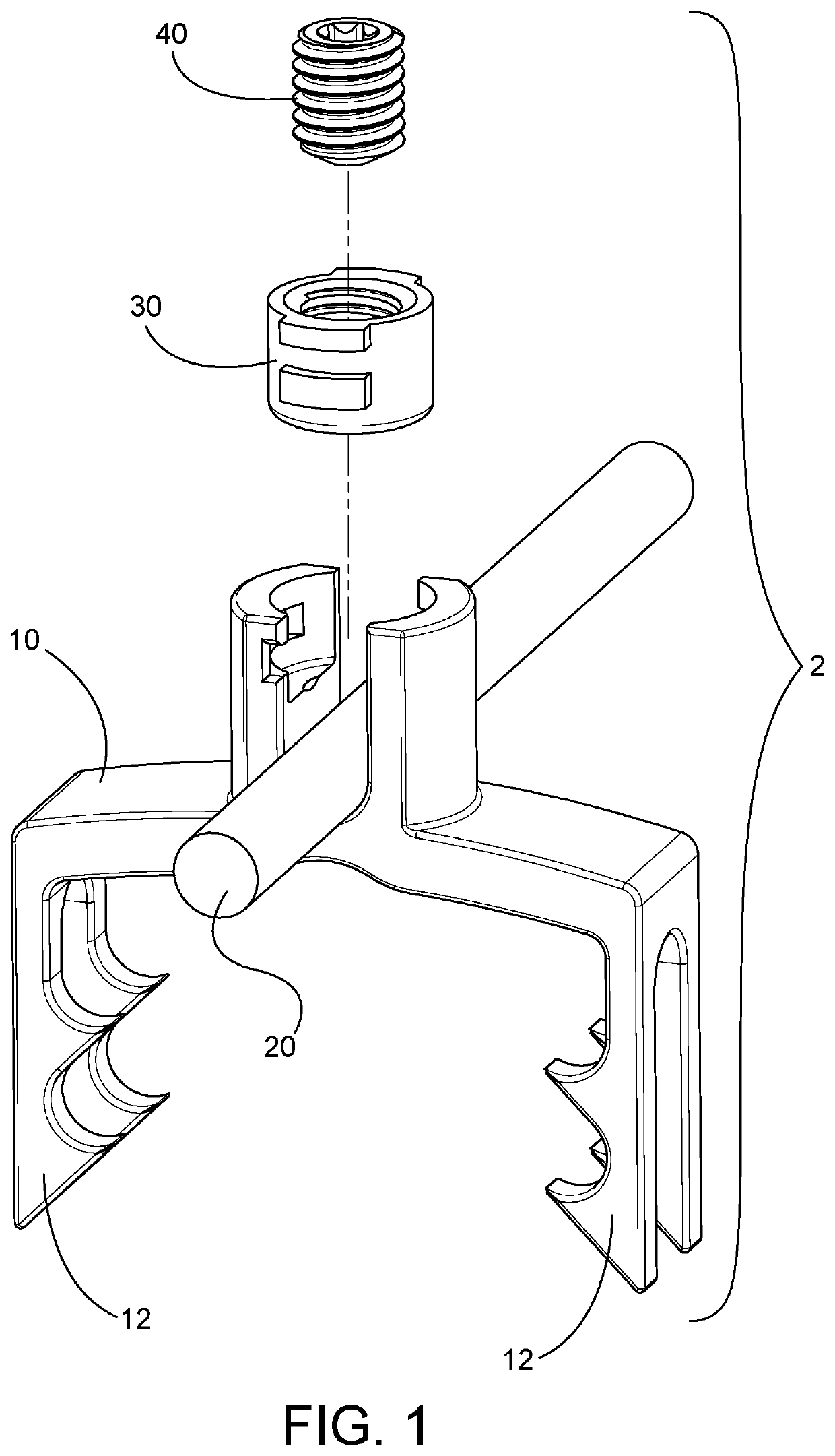 Growth and motion sparing tethers and bone anchor implants for the treatment and correction of spine deformities