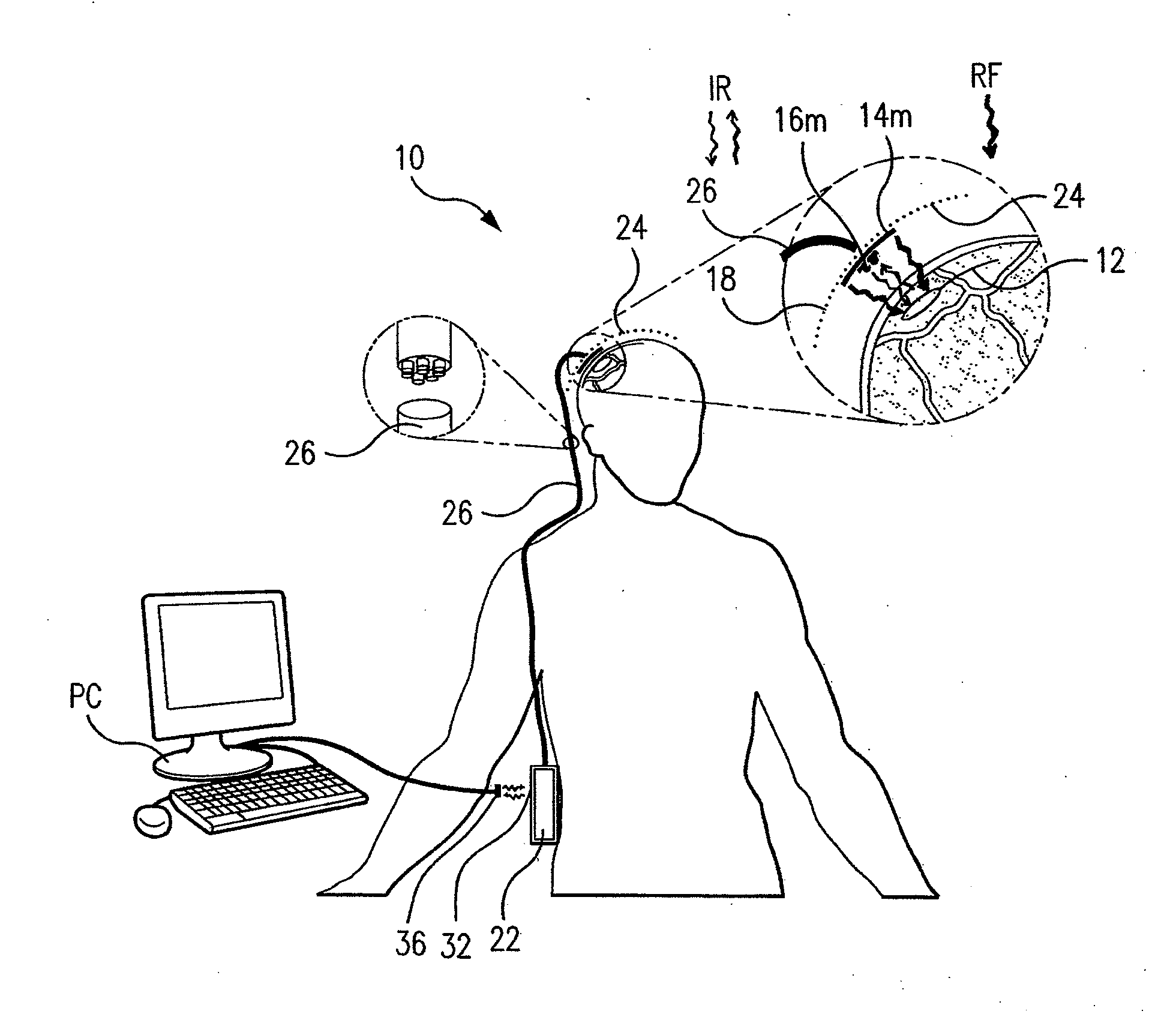 Wireless system for epilepsy monitoring and measurement