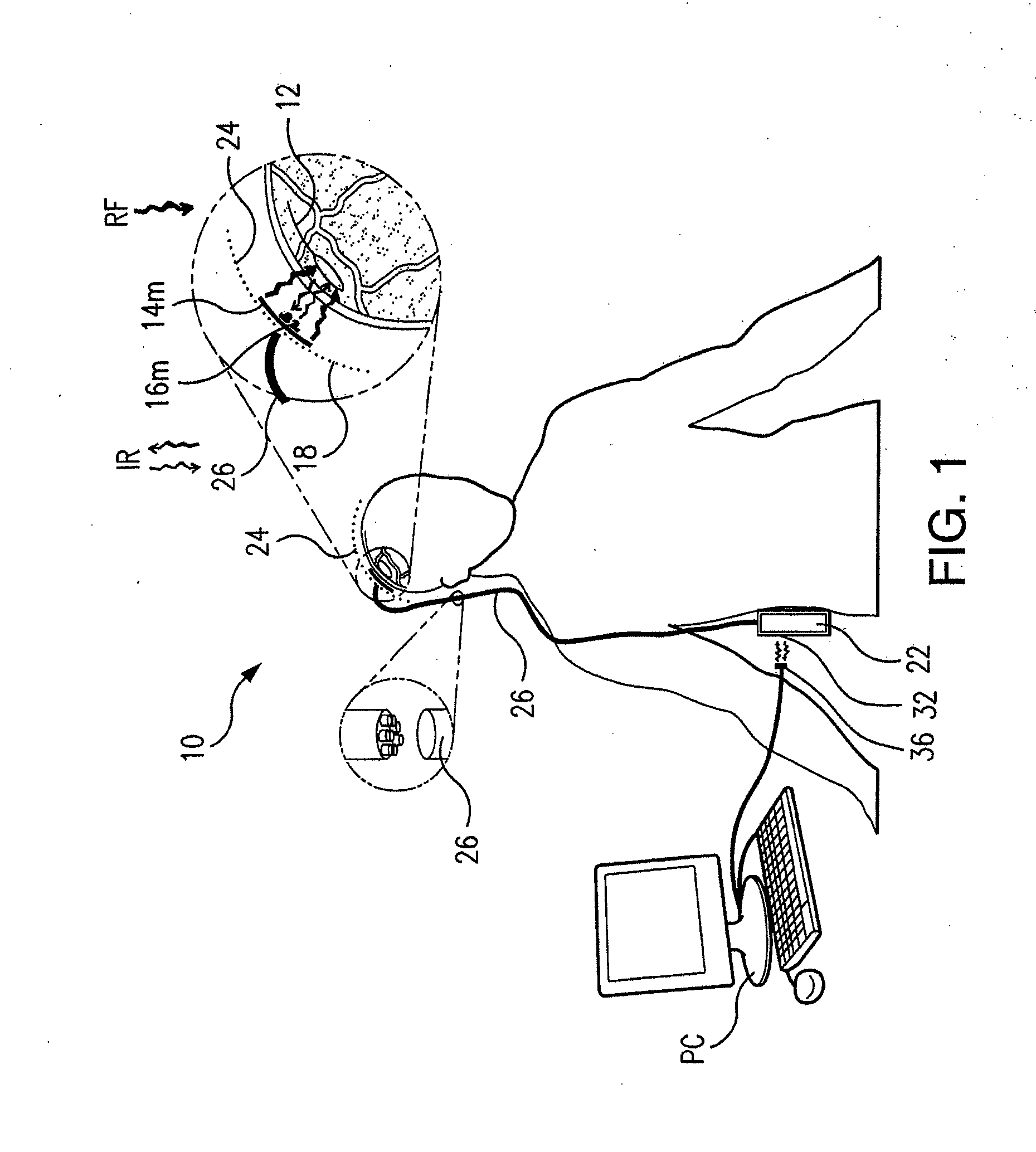 Wireless system for epilepsy monitoring and measurement