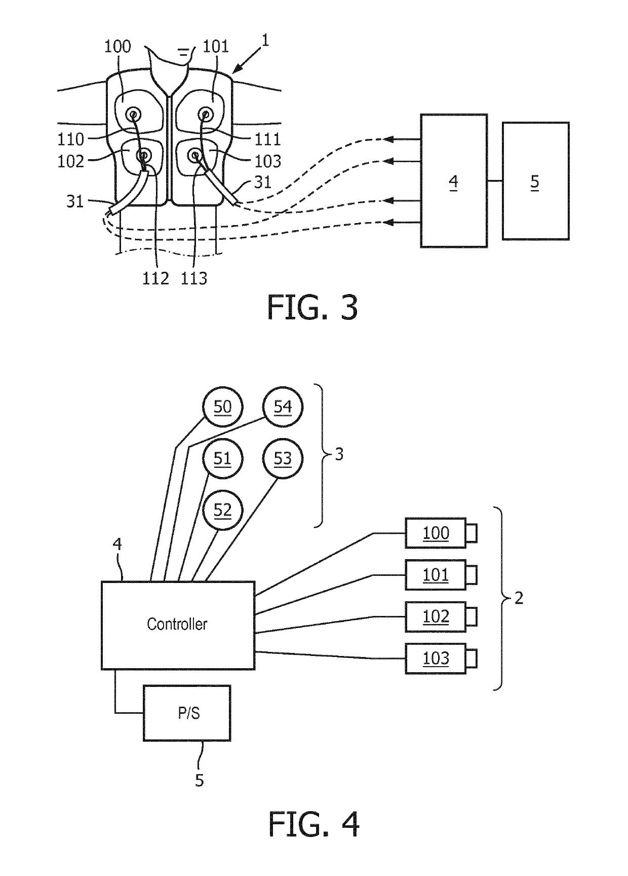 Chest wall oscillation system with digital auscultation