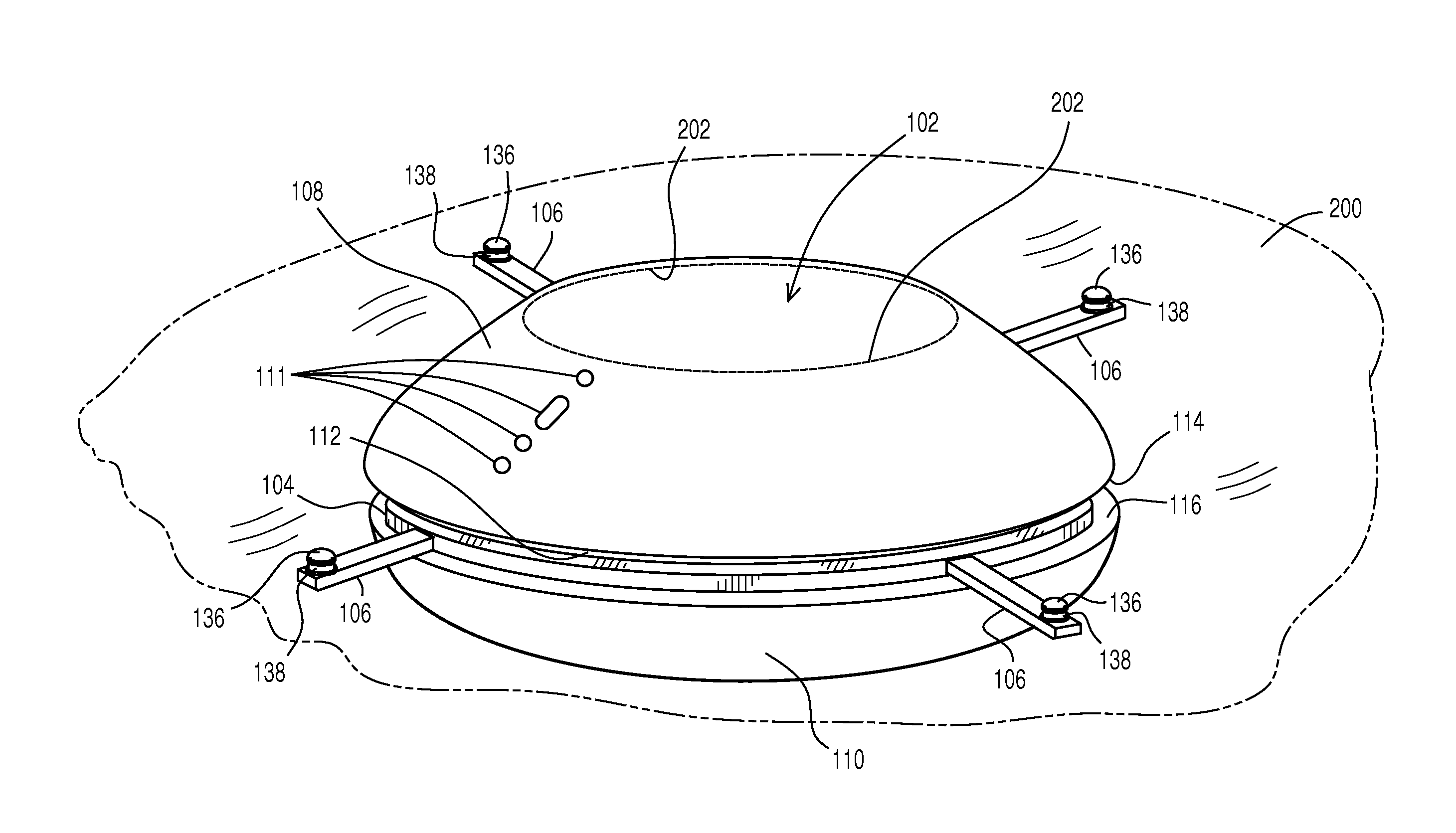 Accommodating intraocular lens